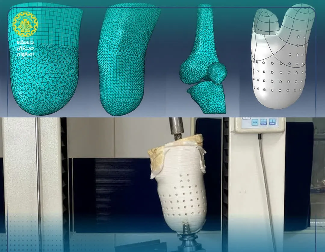 تولید سوکت پای مصنوعی با فناوری چاپ سهبعدی