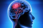 رازهای پیشگیری از سکته از زبان متخصصان مغز و اعصاب